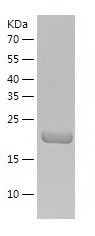    ETHE1 / Recombinant Human ETHE1