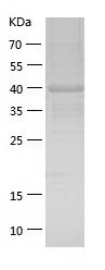    FGFR1 Oncogene Partner / Recombinant Human FGFR1 Oncogene Partner