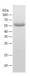    OXSR1 / Recombinant Human OXSR1