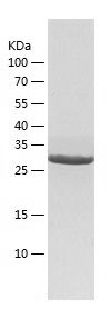    GGPS1 / Recombinant Human GGPS1