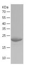    NUDT14 / Recombinant Human NUDT14