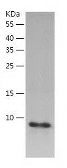    Dynein light chain / Recombinant Human Dynein light chain