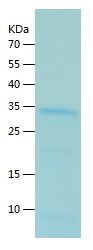    WHSC1 / Recombinant Human WHSC1