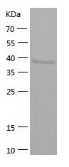    ADH1C / Recombinant Human ADH1C