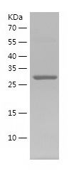    LDHA / Recombinant Human LDHA