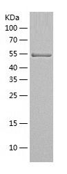    ALDH1A1 / Recombinant Human ALDH1A1