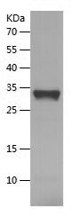    CYB5R3 / Recombinant Human CYB5R3