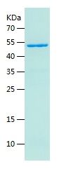    Glutathione Reductase / Recombinant Human Glutathione Reductase