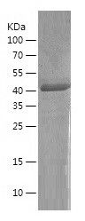    FABP-1 / Recombinant Human FABP-1