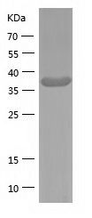    ADA / Recombinant Human ADA