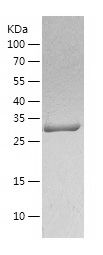    Carbonic Anhydrase 1 / Recombinant Human Carbonic Anhydrase 1