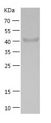    ASS1 / Recombinant Human ASS1