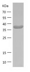    OAS1 / Recombinant Human OAS1