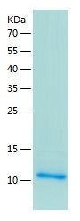    SPINK1 / Recombinant Human SPINK1