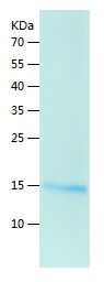    NGF / Recombinant Human NGF