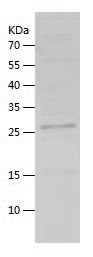    POMC / Recombinant Human POMC