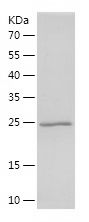    Prolactin / Recombinant Human Prolactin