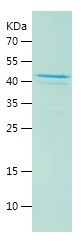    HLA-DR / Recombinant Human HLA-DR