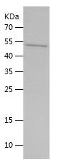    Cytokeratin 14 / Recombinant Human Cytokeratin 14