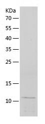    Apolipoprotein CIII / Recombinant Human Apolipoprotein CIII