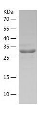    Fibrinogen beta chain / Recombinant Human Fibrinogen beta chain