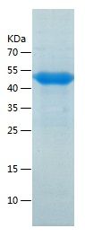    Fibrinogen gamma chain / Recombinant Human Fibrinogen gamma chain