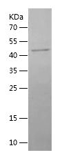    Nicotinic Acetylcholine Receptor alpha 1 / Recombinant Human Nicotinic Acetylcholine Receptor alpha 1