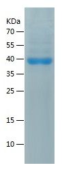    Nicotinic Acetylcholine Receptor alpha 1 / Recombinant Human Nicotinic Acetylcholine Receptor alpha 1