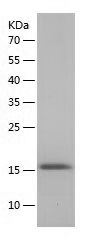    Fibronectin type III EDB / Recombinant Human Fibronectin type III EDB