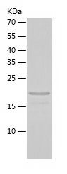    RBP4 / Recombinant Human RBP4