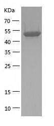    Vitamin D Binding / Recombinant Human Vitamin D Binding