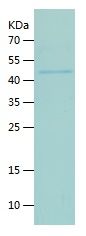    Factor XIa / Recombinant Human Factor XIa