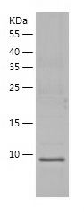    SLPI / Recombinant Human SLPI