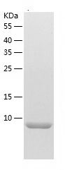    Estrogen Induciblep S2 / Recombinant Human Estrogen Induciblep S2