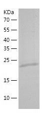    Thymidine Kinase 1 / Recombinant Human Thymidine Kinase 1