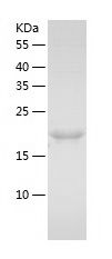    CD74 / Recombinant Human CD74