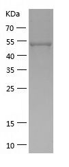    Argininosuccinate Lyase / Recombinant Human Argininosuccinate Lyase