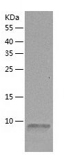    IGF1 / Recombinant Human IGF1