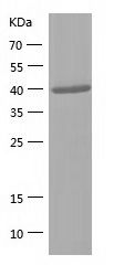    Aldolase B / Recombinant Human Aldolase B