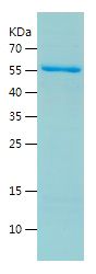    ALDH2 / Recombinant Human ALDH2