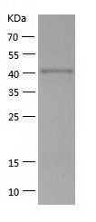    SerpinB2 / Recombinant Human SerpinB2