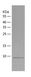 Recombinant Mouse SAA1