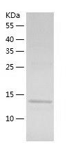    RPLP2 / Recombinant Human RPLP2