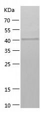    SSB / Recombinant Human SSB