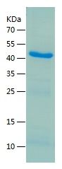    Cytokeratin 18 / Recombinant Human Cytokeratin 18