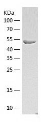    Cytokeratin 8 / Recombinant Human Cytokeratin 8