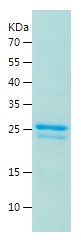    beta Casein / Recombinant Human beta Casein