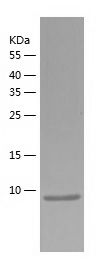    S100 alpha 6 / Recombinant Human S100 alpha 6