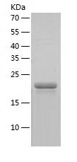    CD2 / Recombinant Human CD2