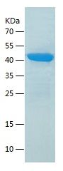    Creatine Kinase MM / Recombinant Human Creatine Kinase MM